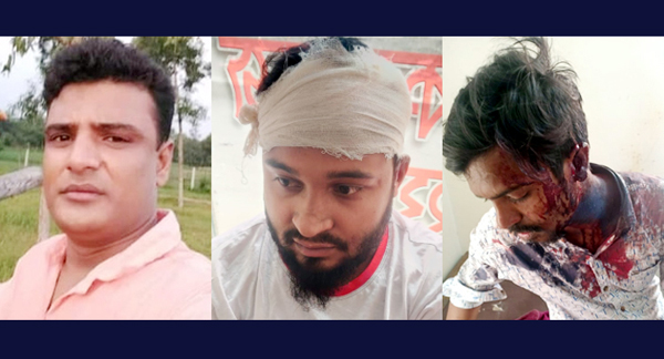 ফতুল্লায় দুর্ধর্ষ পিচ্চি মিজানের হামলায় চারজন আহত