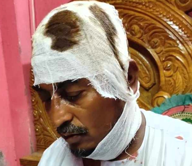 কাশীপুরে হাতপাখার চেয়ারম্যান প্রার্থীর উপরে সন্ত্রাসী হামলা