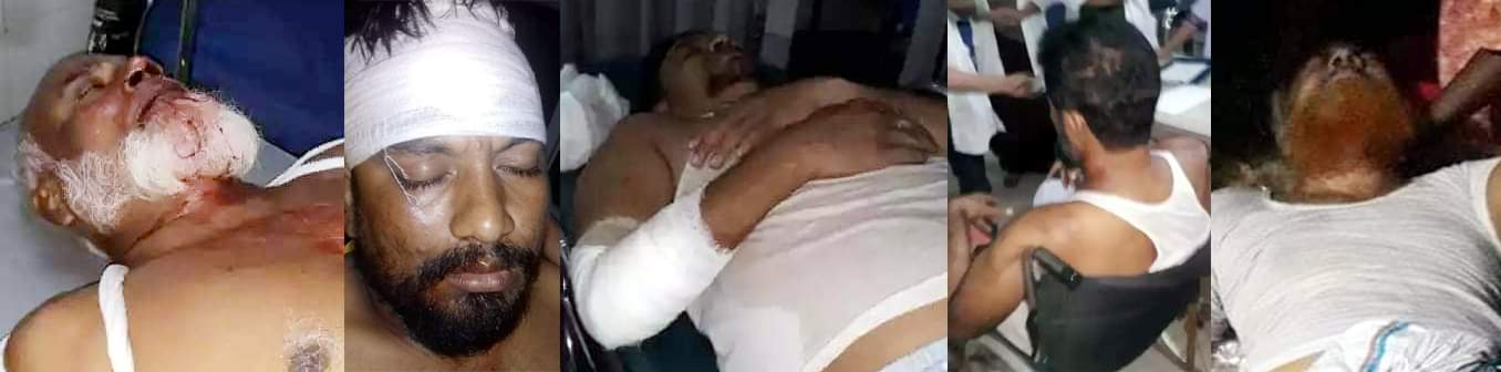 মদনপুরে মেম্বার প্রার্থী আক্তার হোসেনের উপর হামলা